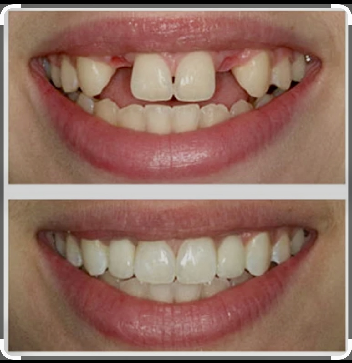 Emergency Dentist Pasadena