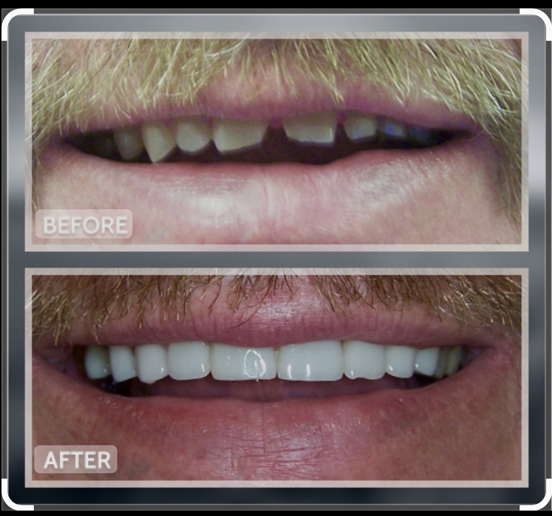 Pasadena Cosmetic Dentist