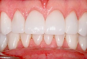 Belle Smile | TMJ Disorders, Cosmetic Dentistry and Digital Impressions