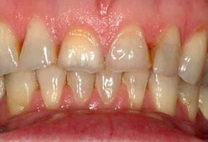 Belle Smile | Oral Exams, Periodontal Treatment and Veneers